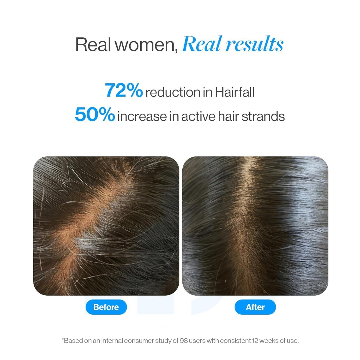 Be Bodywise Hair Growth Serum Roll On 3% Redensyl 2% Anagain 25ml
