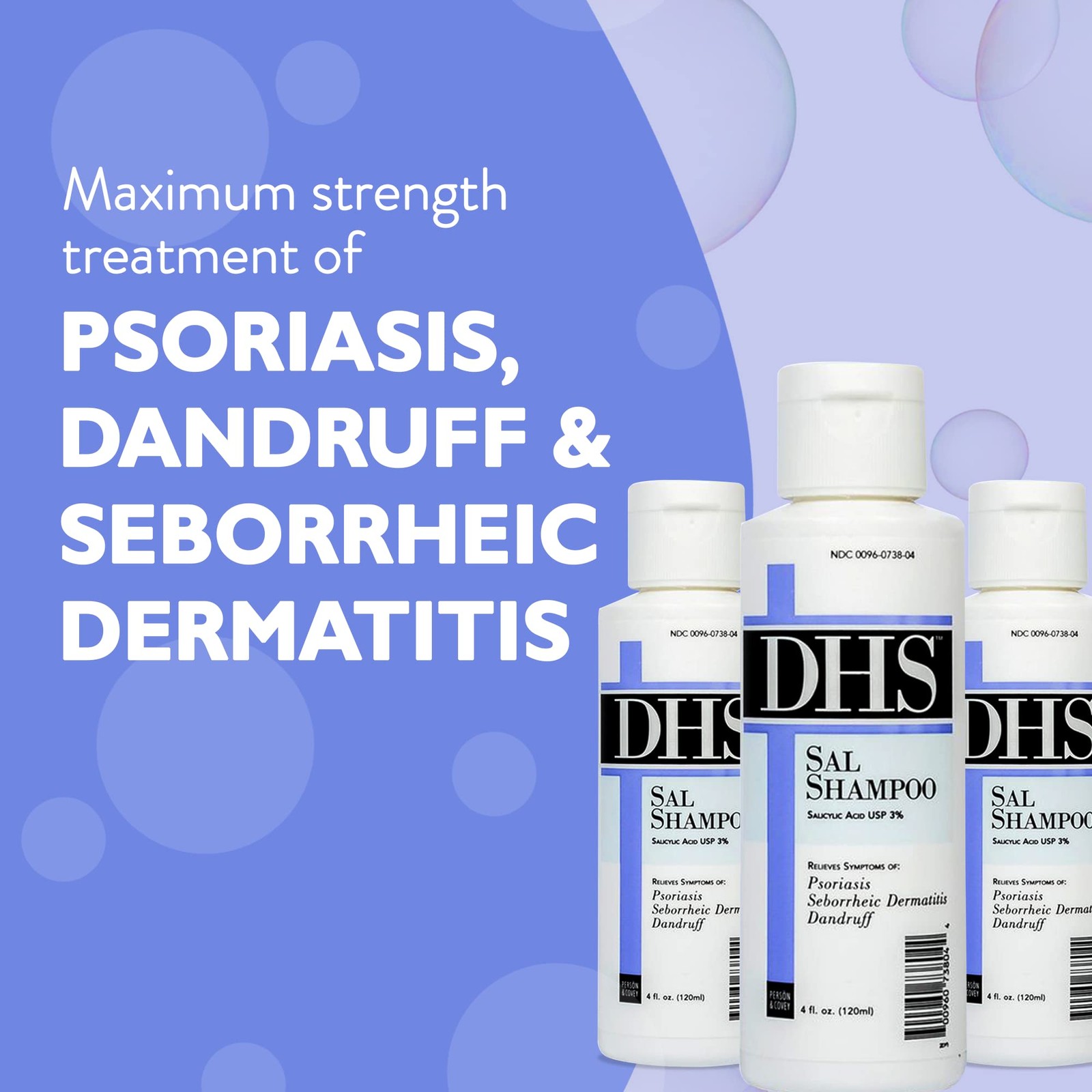 DHS SAL Shampoo – Maximum Strength for Psoriasis, 12 Fl Oz (Pack of 1)