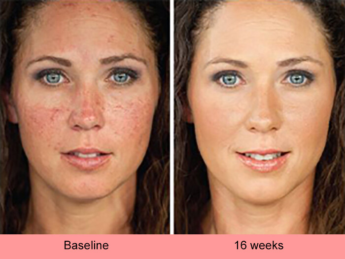 Dark Skin Whitening Lightening Ultra Brightening Serum Dark Spot Bleaching Cream