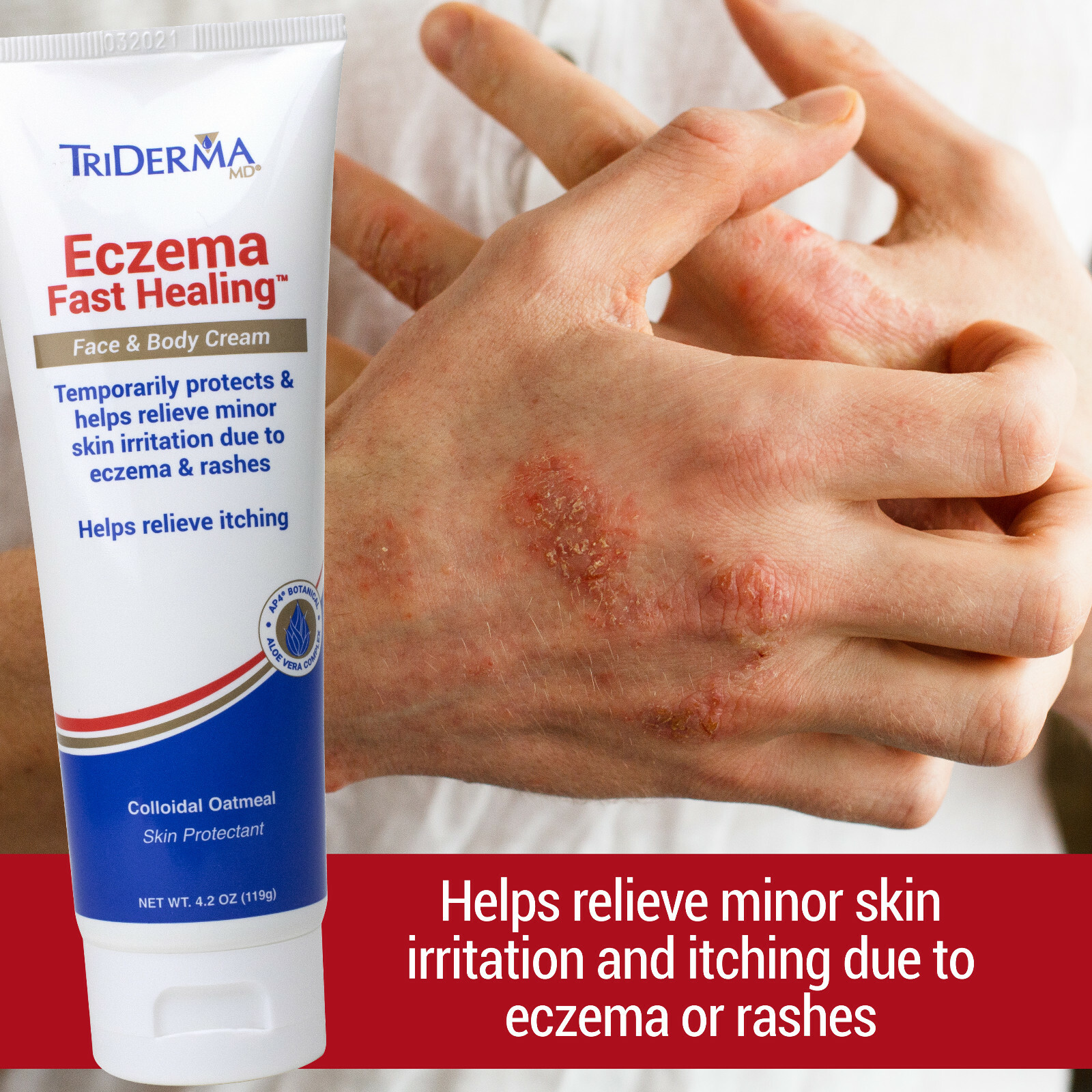 TriDerma Eczema Fast Healing Face & Body Cream, Maximum Strength 4.2 oz