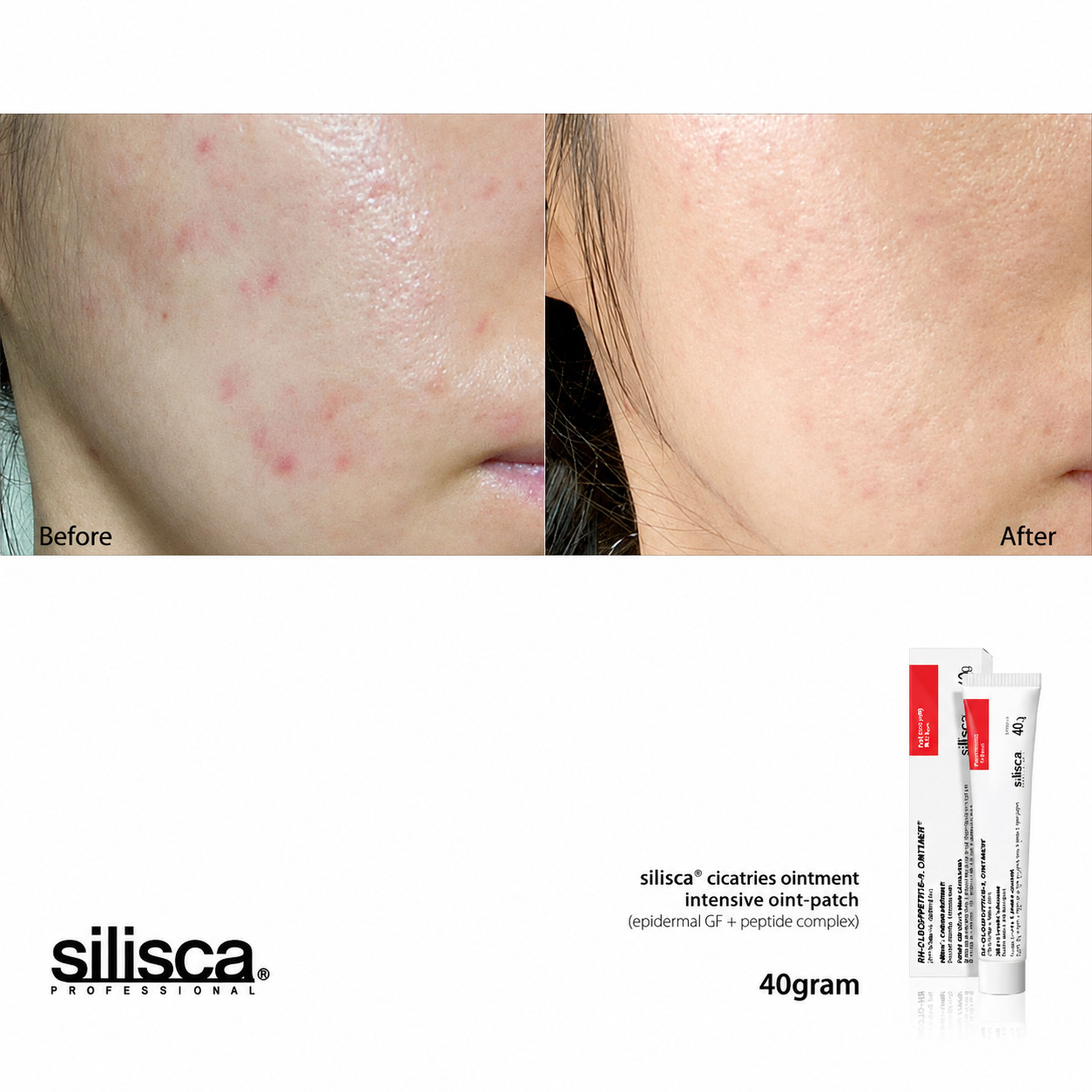 Silisca Cicatries Ointment 40g Intensive Skin Recovery Cream+FREE SAMPLES