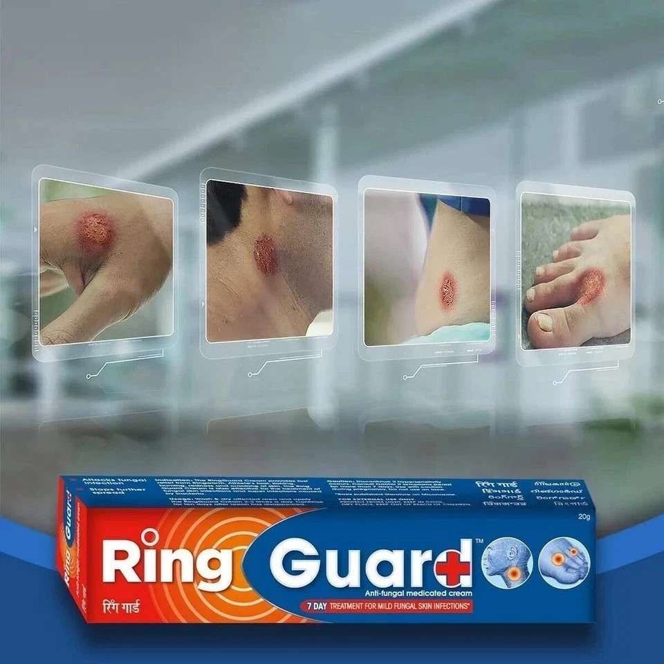 Ring Guard Antifungal Medicated Cream, 20 gm, Relieves itching and redness.