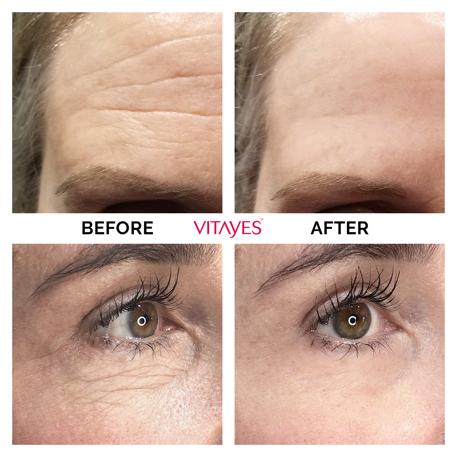 VITAYES Instant Ageback Anti-Aging Facelift Cream (15 ml Tube)
