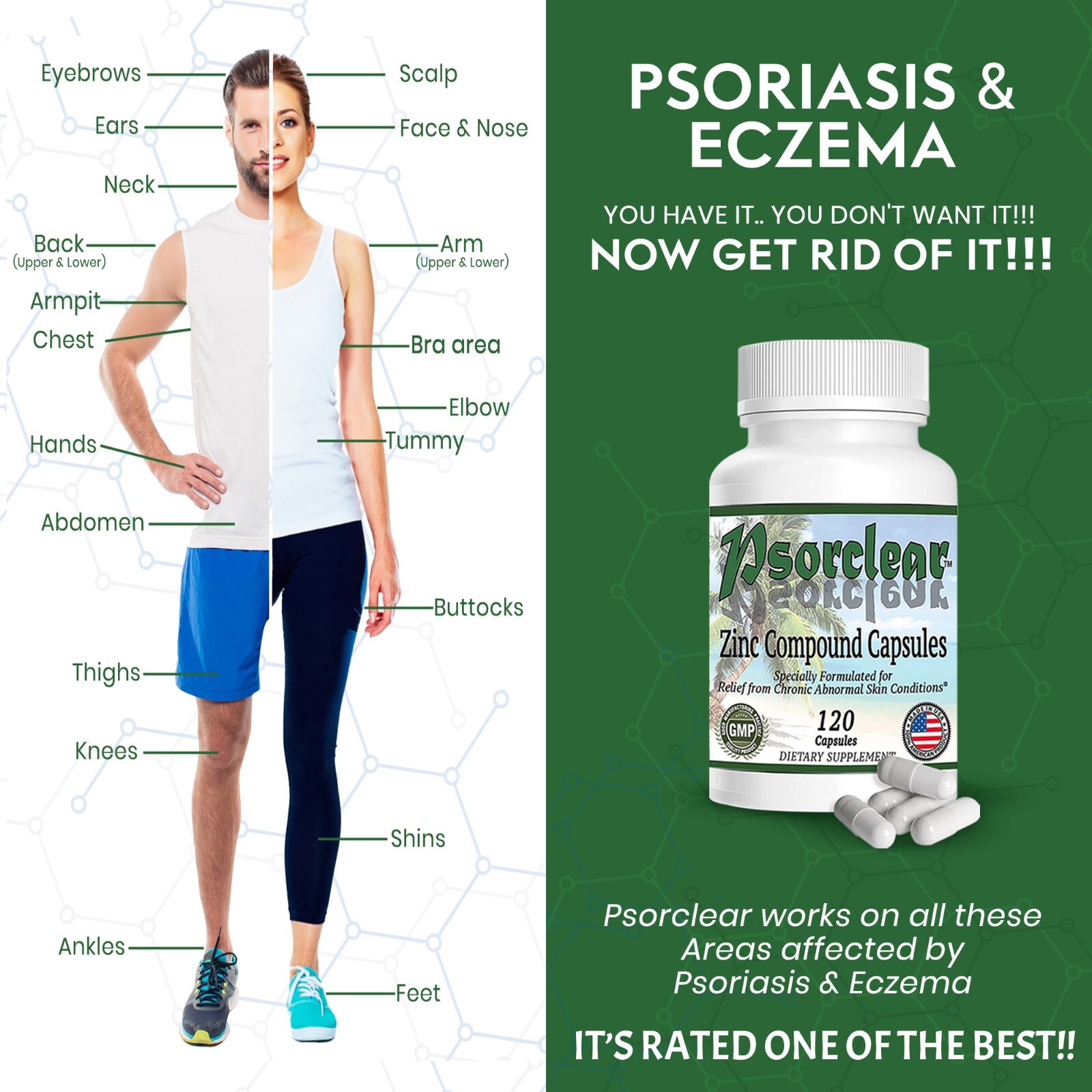 Psorclear – Proven Effective Treatment for Psoriasis & Eczema that REALLY WORKS!