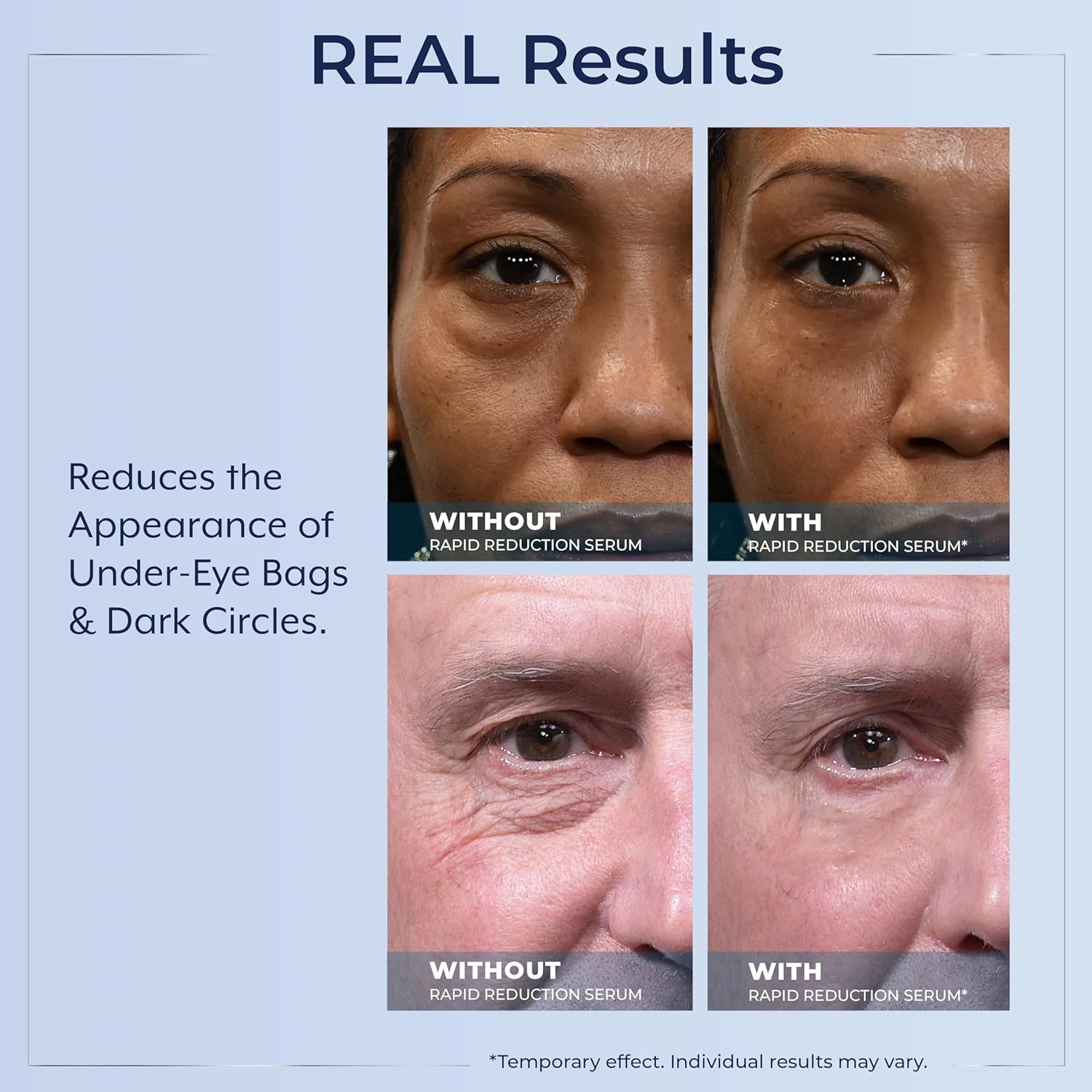 3X Plexaderm Rapid Reduction Eye Serum – Visibly Reduces Under-Eye Bags,Wrinkles