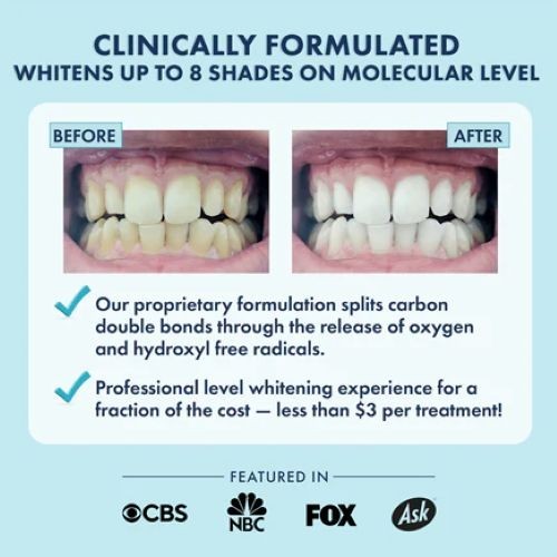 LIVFRESH Whitening Strips USE DAILY FOR 14 Days up to 8 shades whiter