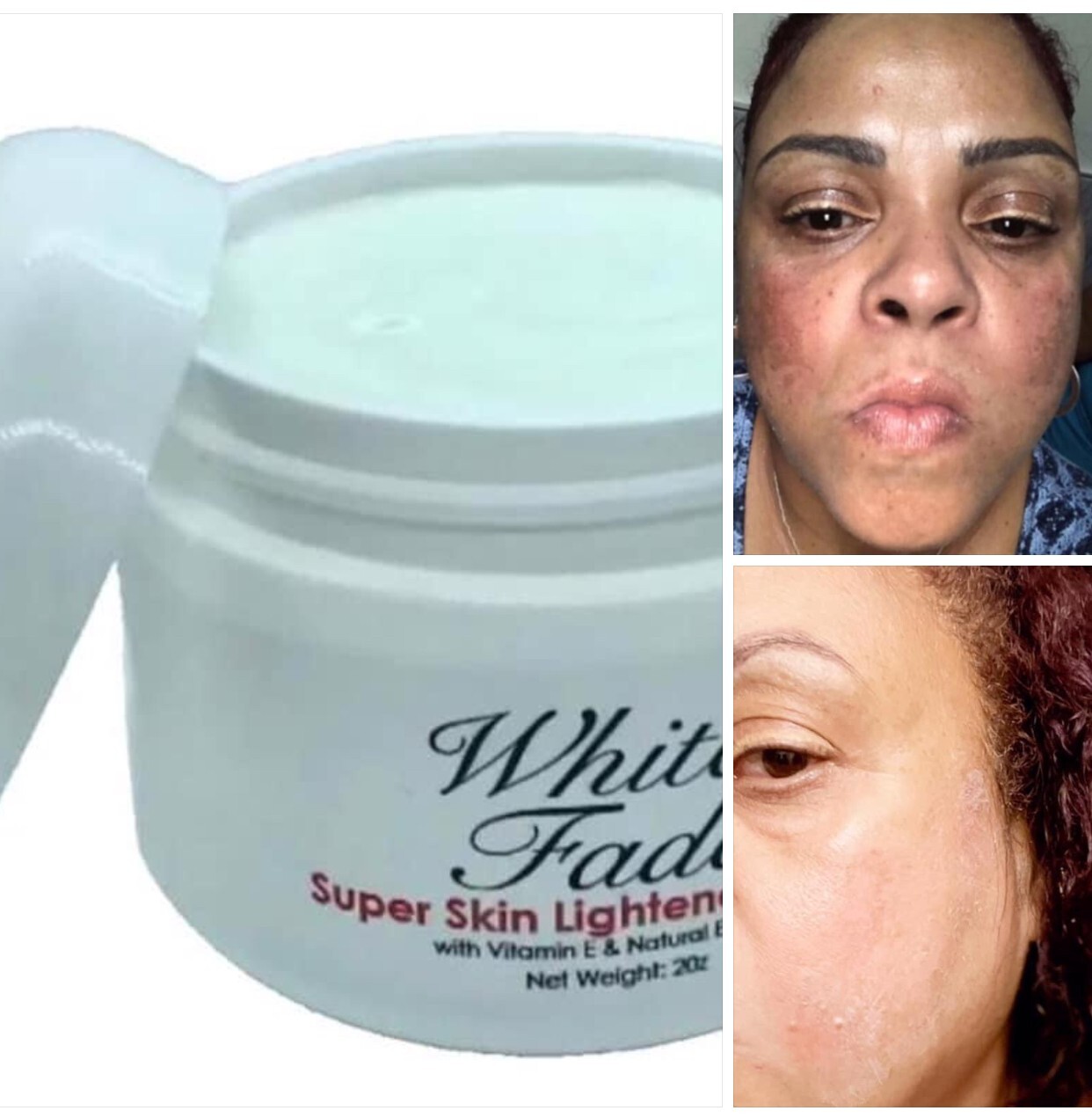 Super Skin Lightener Cream, Eliminan Las Manchas Oscuras Para Piel Clara, 5 oz.