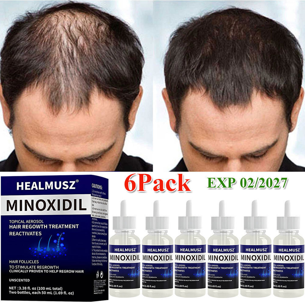 6Pack Minoxidil 5% Extra Strength Hair Regrowth Treatment for Men 6 Month Supply