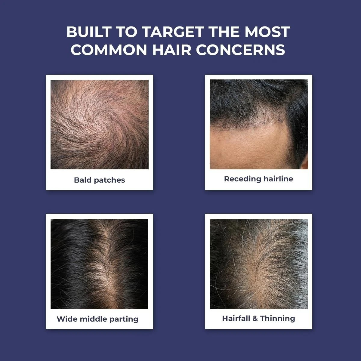 Conscious Chemist® Hair Growth & Anti Hair Fall Serum 30ml
