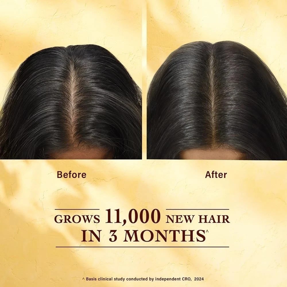 Indulekha Bringha Hair Growth Treatment Scalp Serum ,30ml