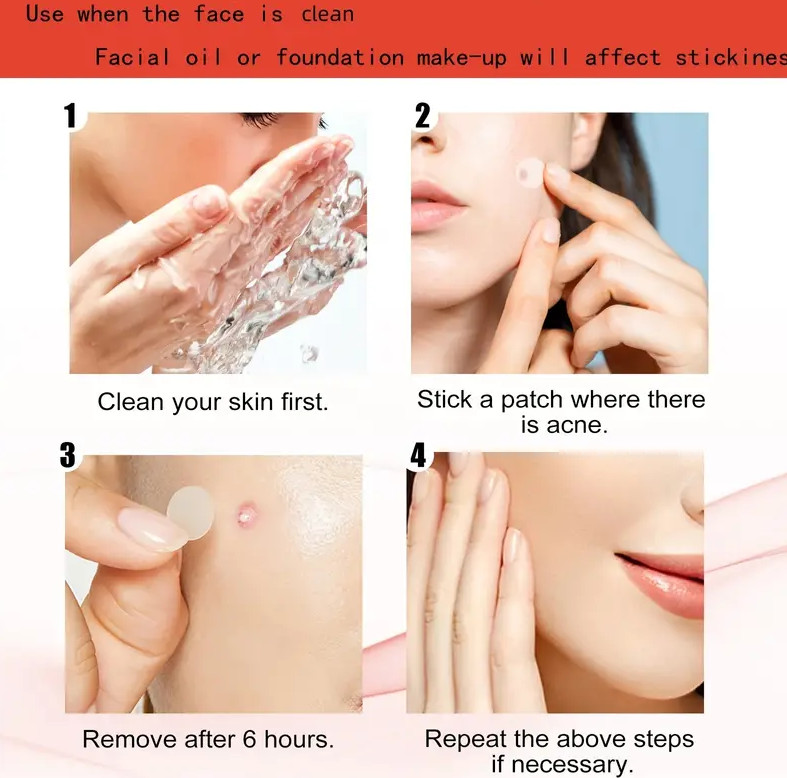 36 Pimple Patches Dots Hydrocolloid Acne Spot Stickers Cystic Acne Patch Heal