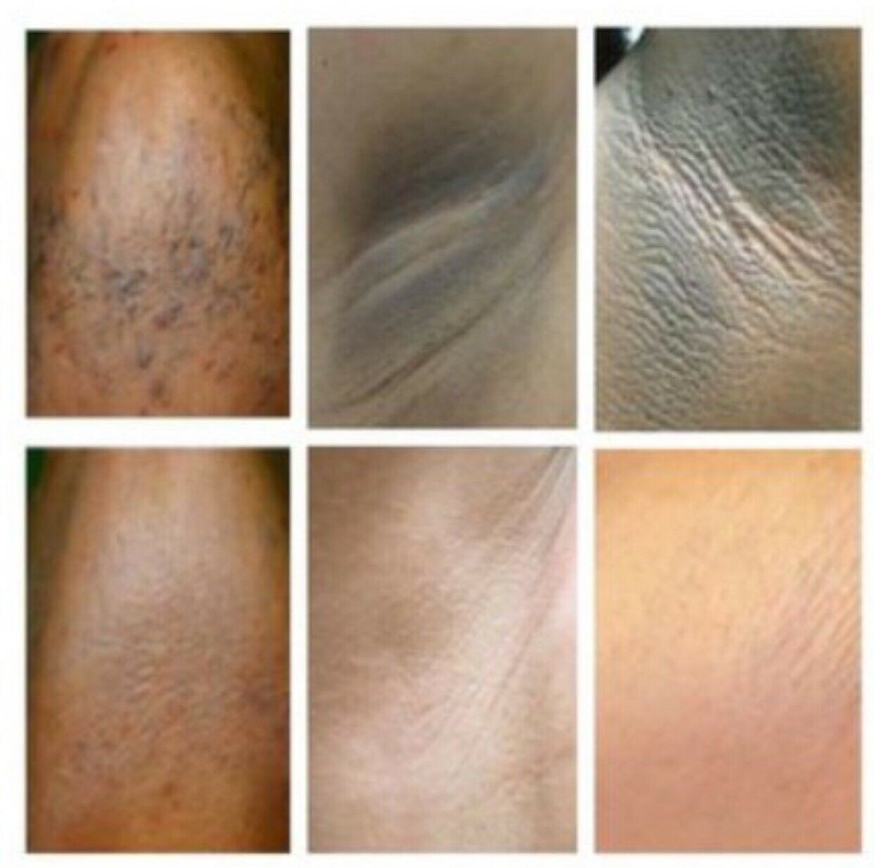 Dark Skin Whitening Dark spot Brightening Bleaching Lightening Face body Cream