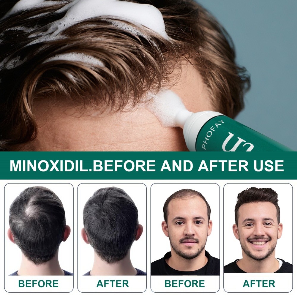 Anti-Hair Loss Mousse Thicker And Fuller Hair