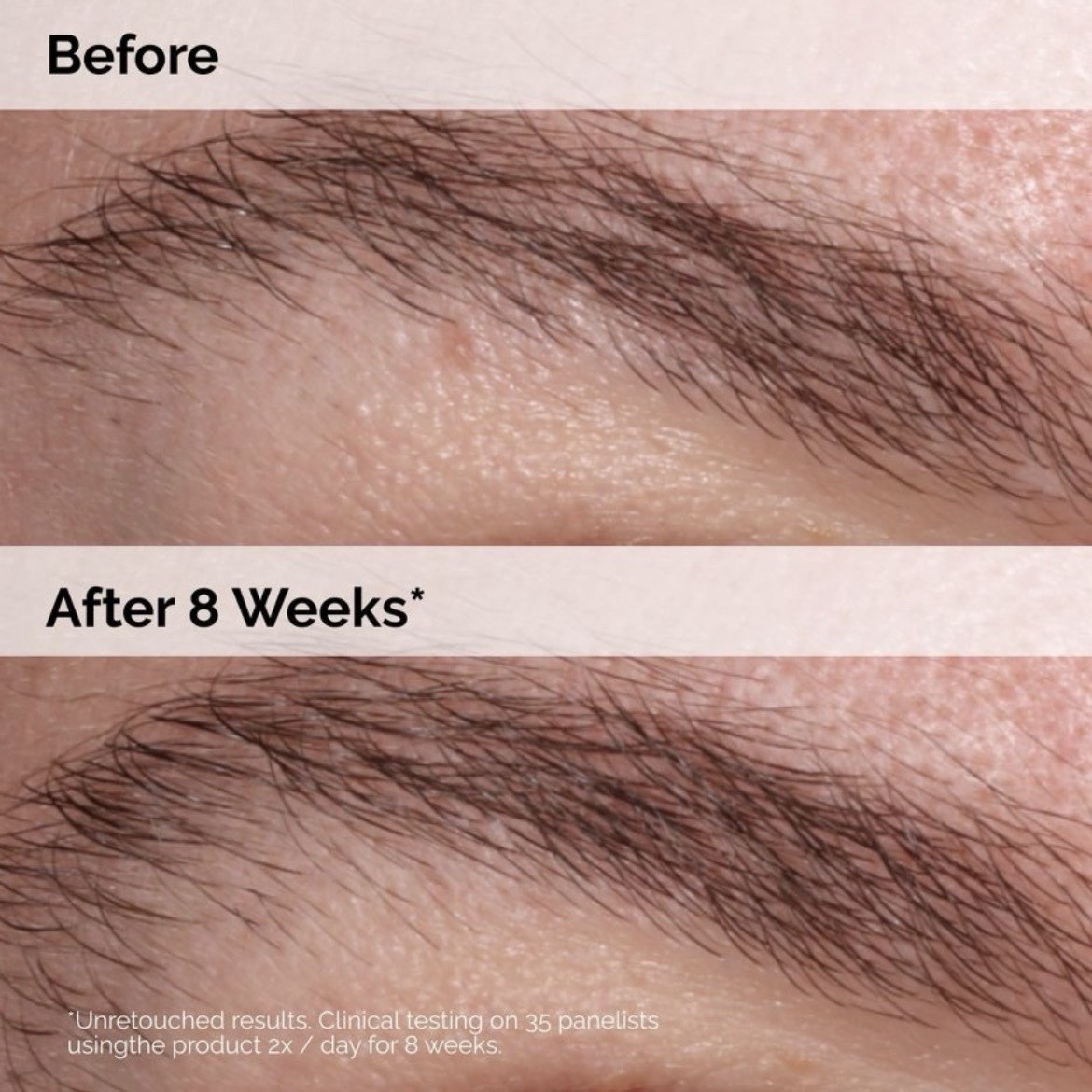 The Ordinary Multi-Peptide Lash & Brow Serum – Prostaglandin-Free 0.16 fl oz 🔥