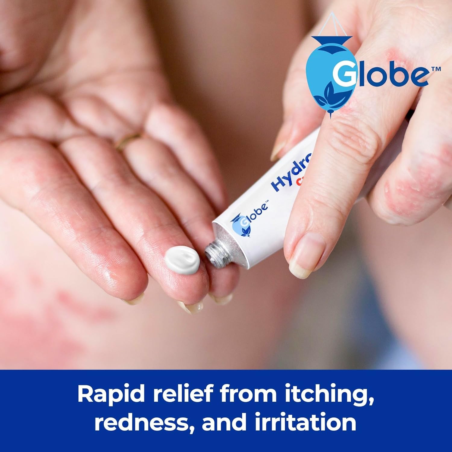 Globe 4 Pack Hydrocortisone 1% Anti-Itch Cream Max Strength Aloe Eczema Rash 1oz