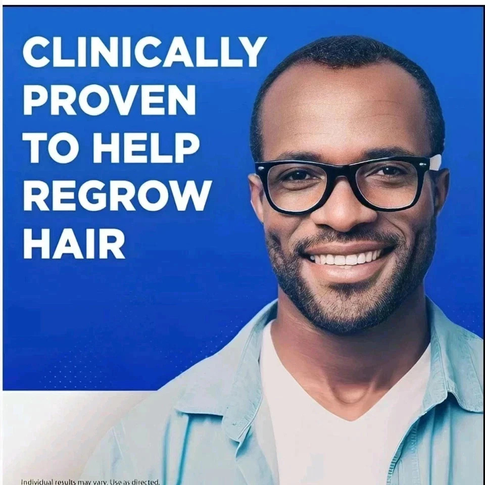 Minoxidil 5% Extra Strength Men 6 Month Supply Hair Regrowth Solution Free Ship