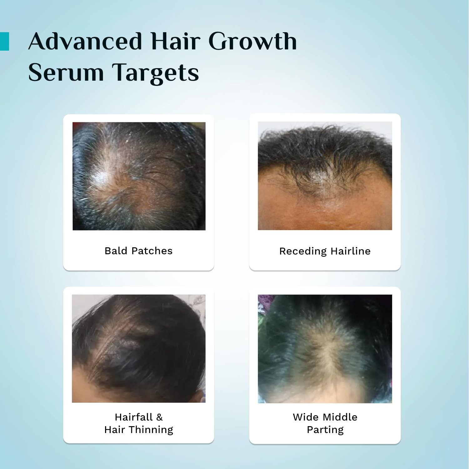 Pilgrim Advanced Hair Growth Serum Redensyl Anagain Rosemary pack of 30ml x 2