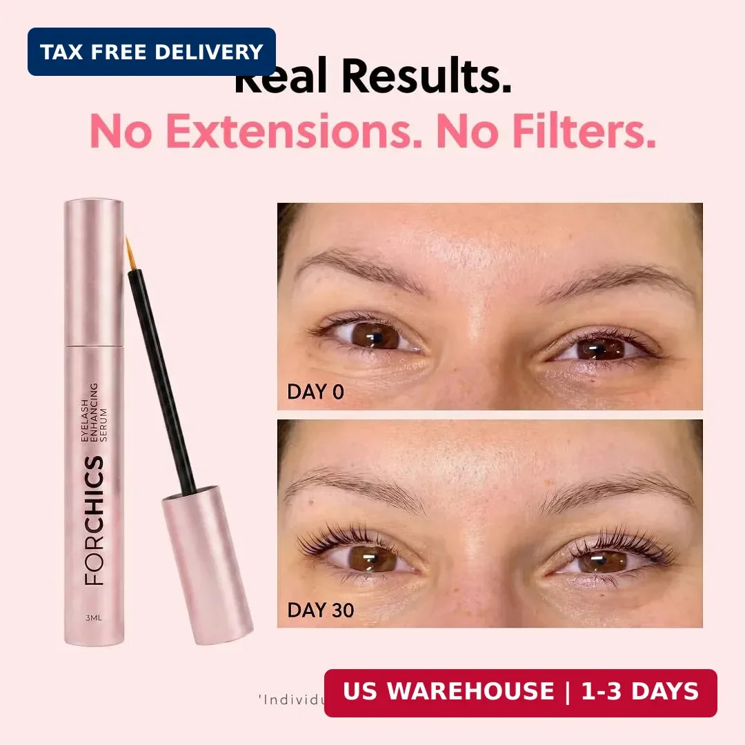 ForChics Eyelash Growth Serum – Prostaglandin-Free Lash Enhancing Serum for Long