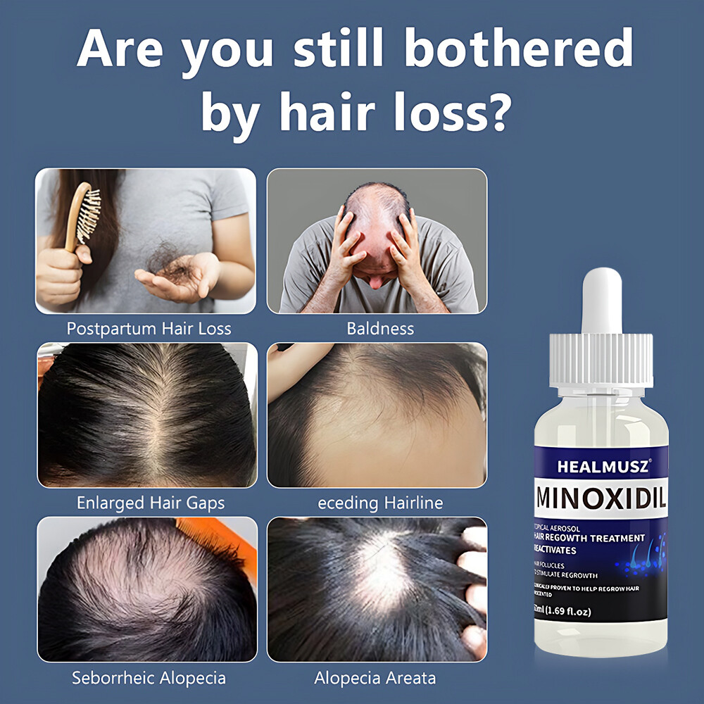 HEALMUSZ Minoxidil 5% Hair Regrowth Treatment Topical Aerosol Solution 2x50ml