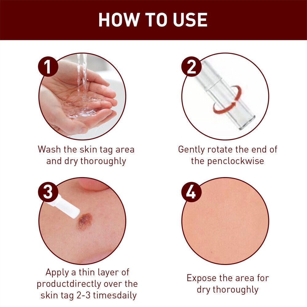 “FINAL SAL” Skin Tags & Moles Removal Quick Safe Remover Restore Skin 3ml US