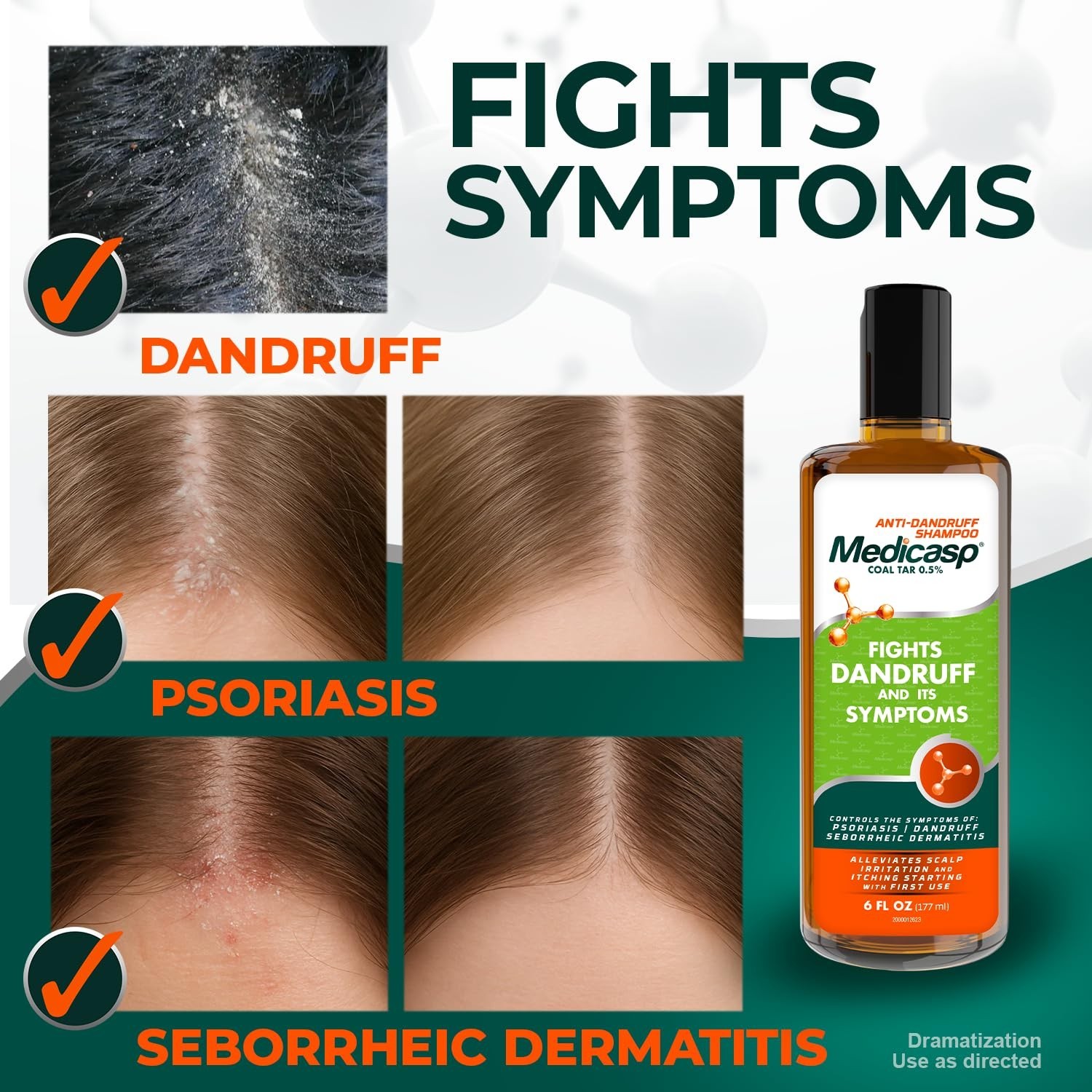 Anti-Dandruff Shampoo 2-Pack – Treats Psoriasis, Dry Scalp & Flakes, 6 fl oz