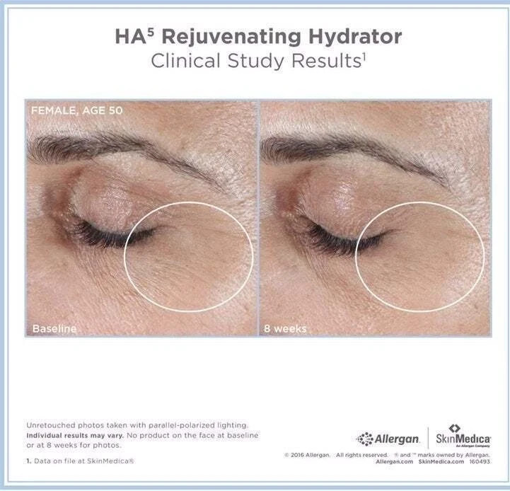 NEW Sealed SkinMedica HA5 Rejuvenating Hydrator – 2 oz.~ Authentic (Pack OF 2 )