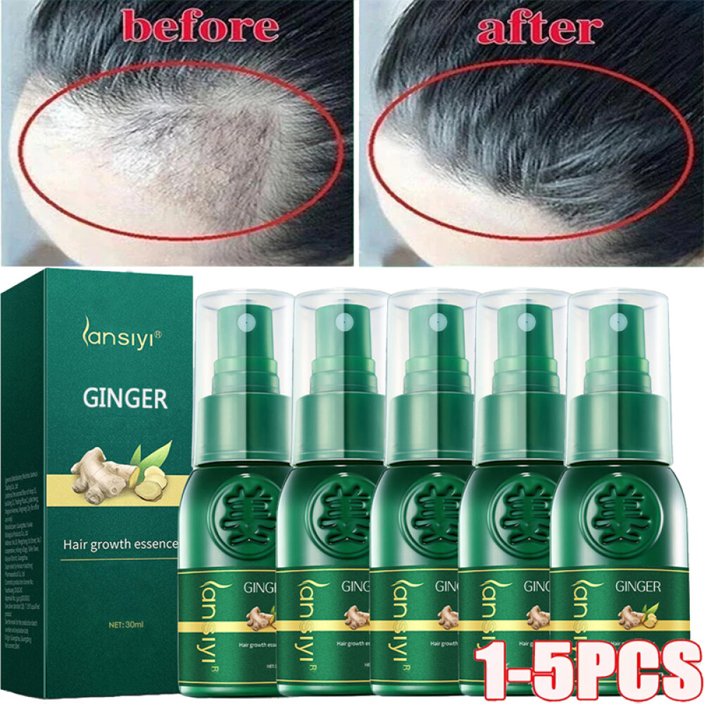 Herbal Ginger Hair Growth Spray Anti Hair Loss Treatment Dense Regrowth Essence.