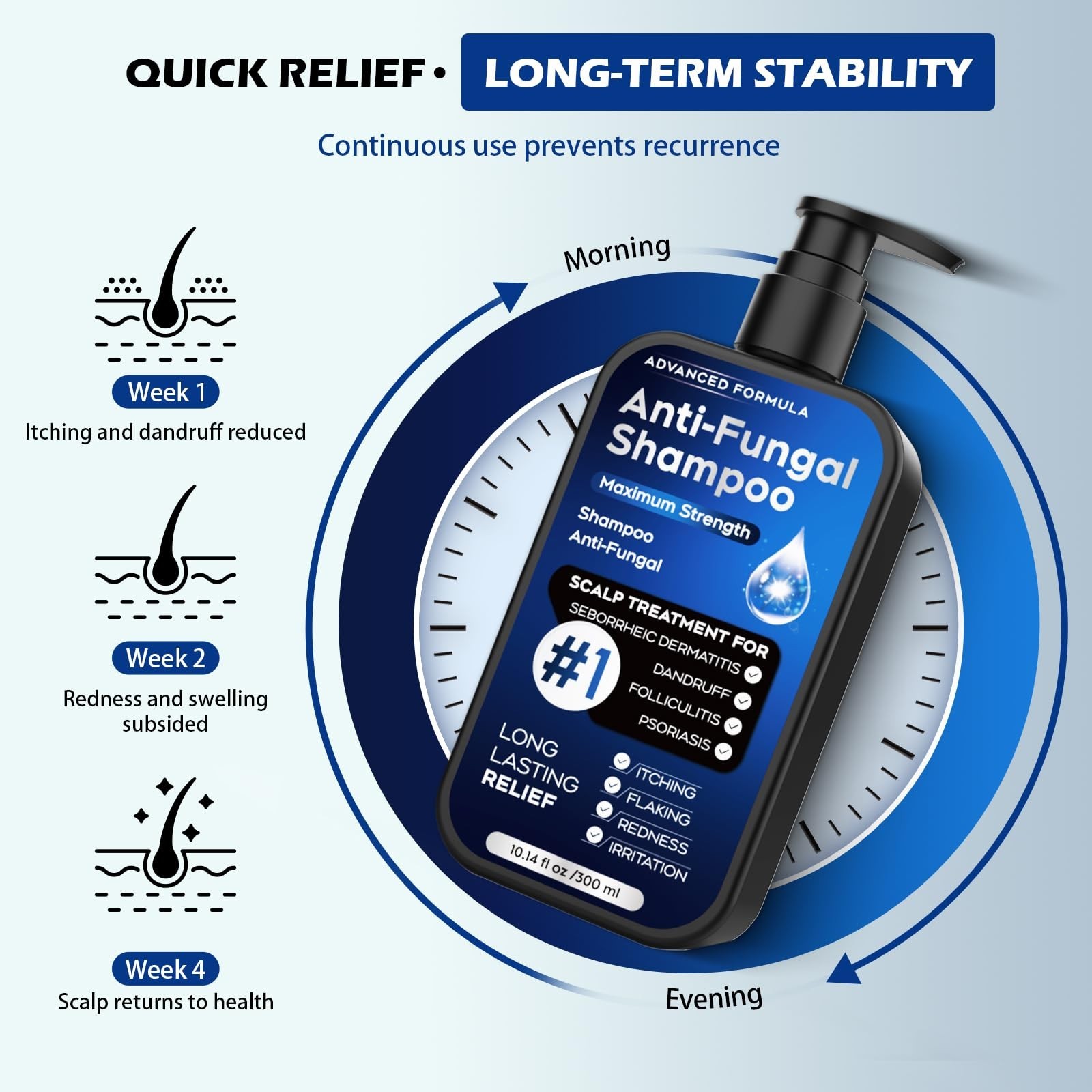 Antifungal Shampoo for Psoriasis, Seborrheic Dermatitis & Dandruff Relief, 10.1