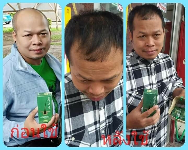 2024 Neo Hair Lotion 100% Original Authentic. MFG : 01/07/2024