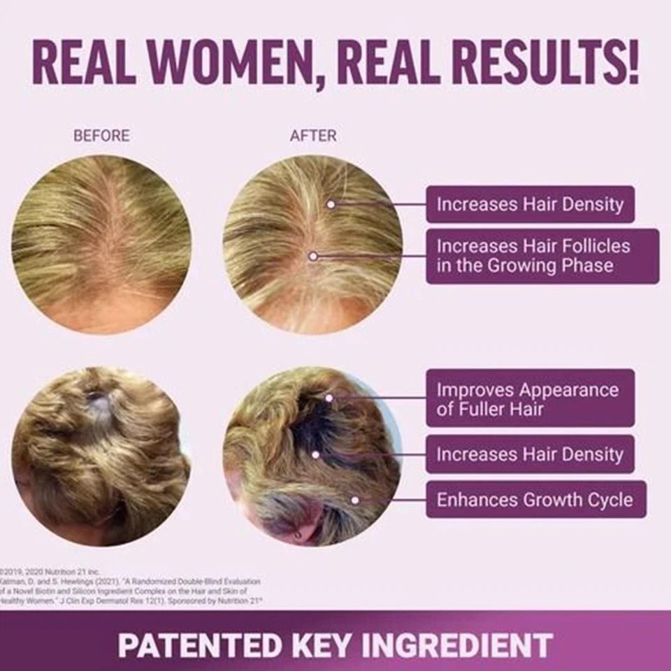 Force Factor Hair Growth Accelerator Soft Chews, Hair Growth Vitamins For Women