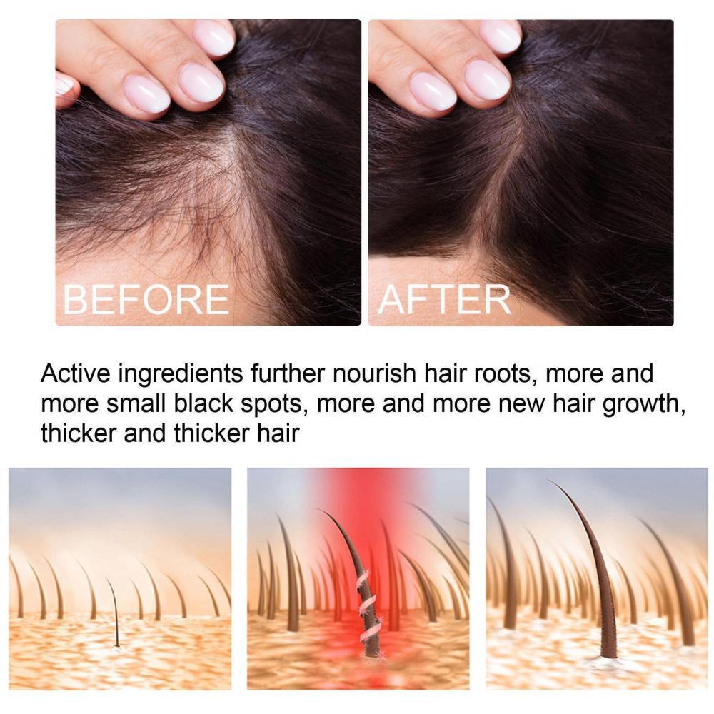 Herbal Ginger Hair Growth Spray Anti Hair Loss Treatment Dense Regrowth Essence.