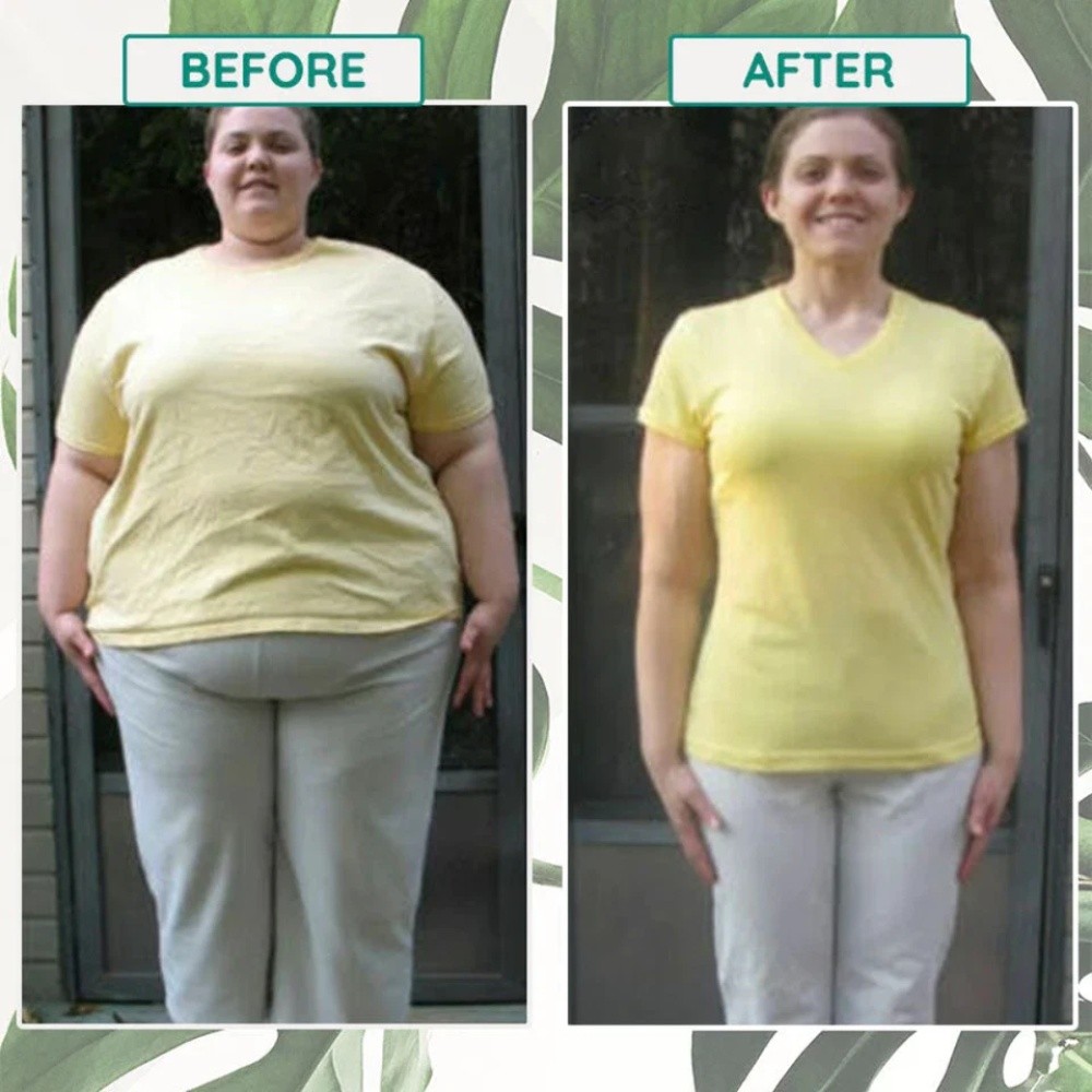 🔥 Extra Strong Slim Patches Weight Loss Burn Fat Diet Fast Acting Slimming Pads