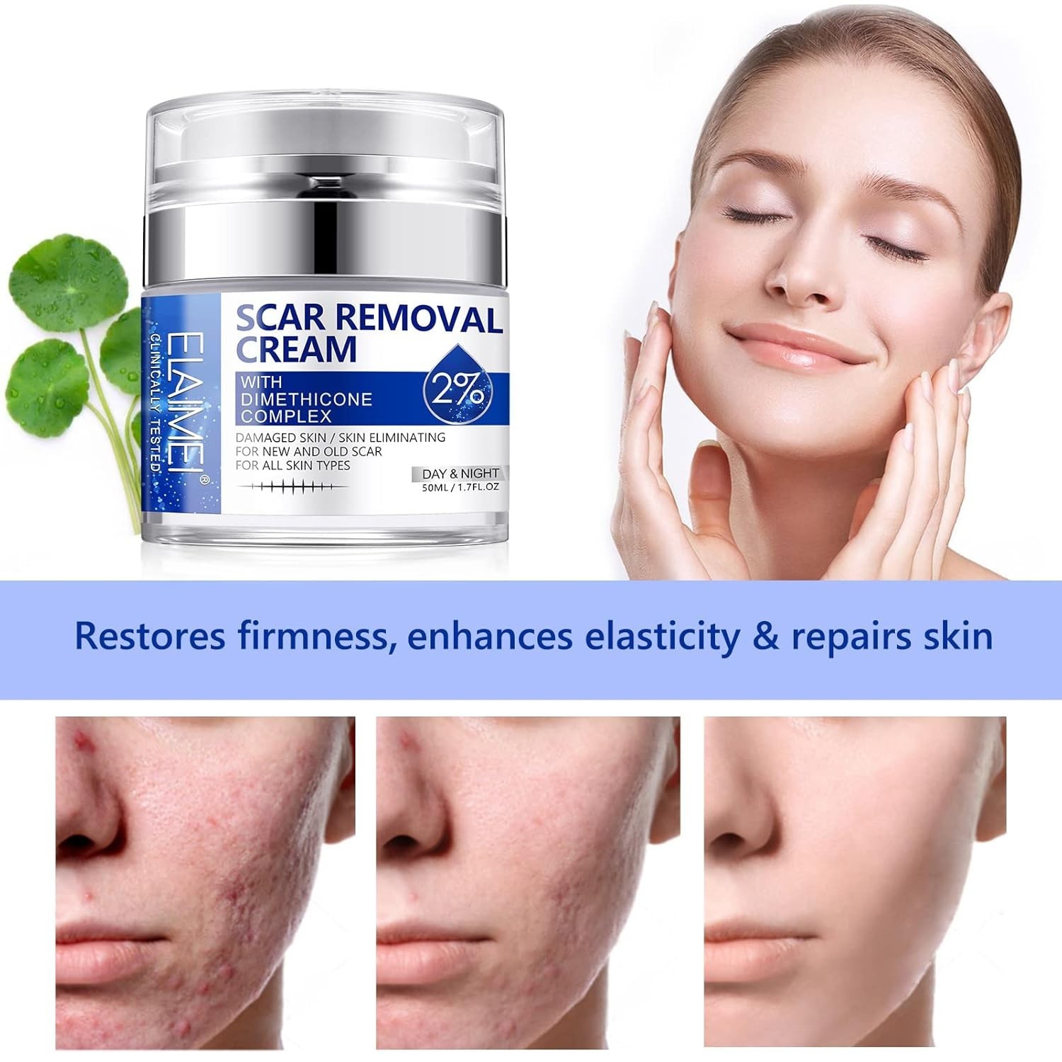 Ungüento Crema Avanzada Para Eliminar Cicatrices Quirúrgicas Quemaduras y Acné
