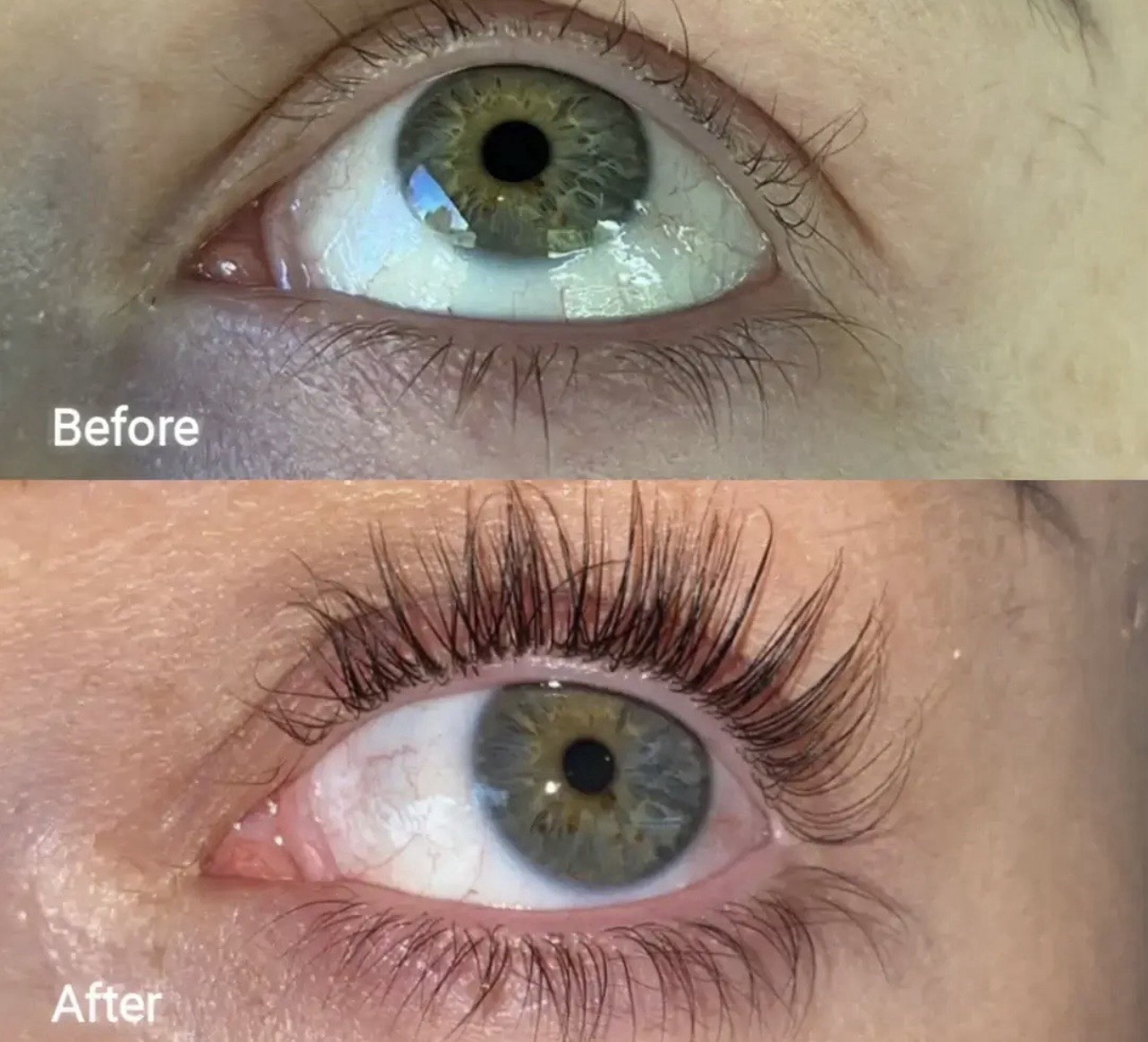 Forchics Eyelash Growth Serum – Prostaglandin-Free Lash Enhancing Serum for Long