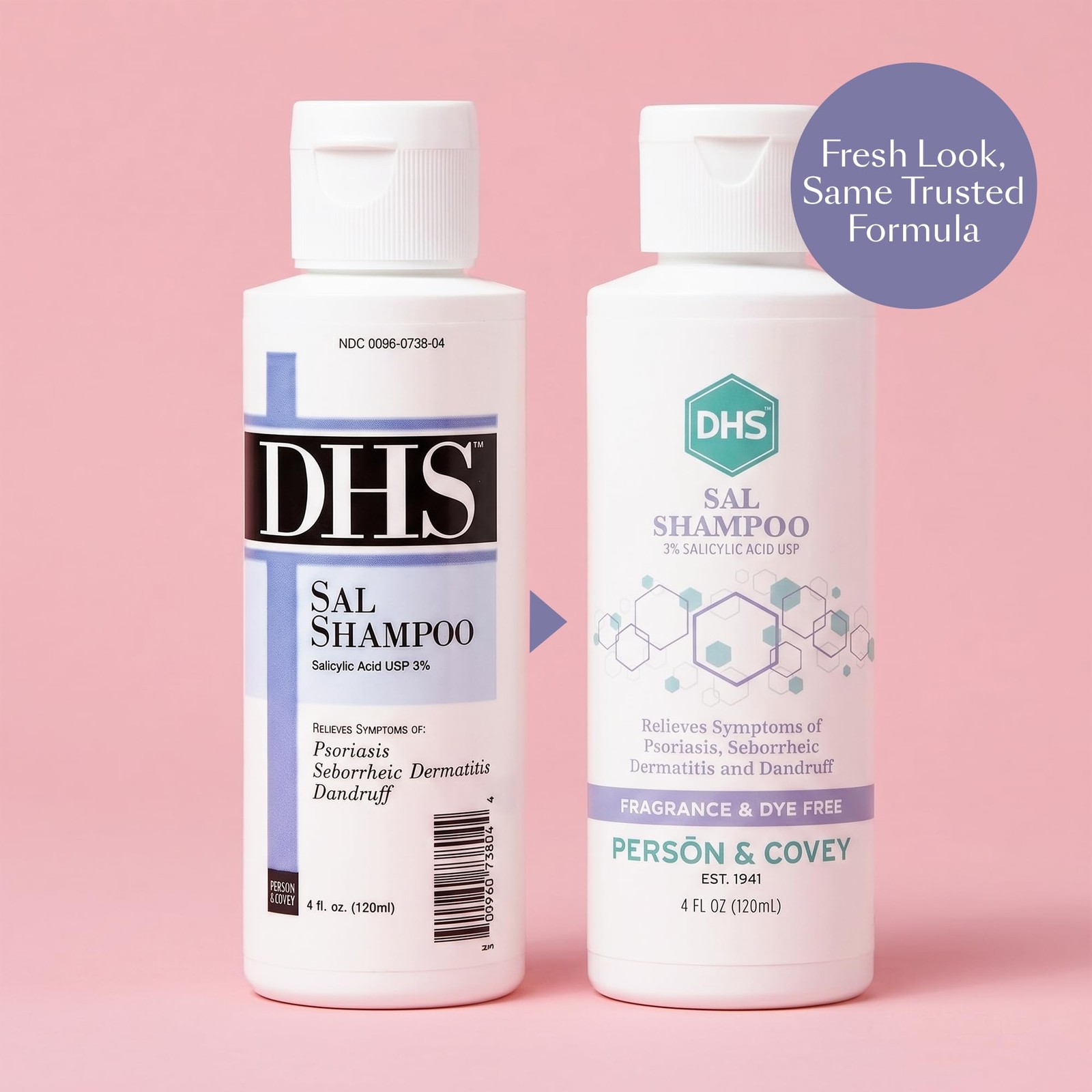 DHS SAL Shampoo – Maximum Strength for Psoriasis, 12 Fl Oz (Pack of 1)