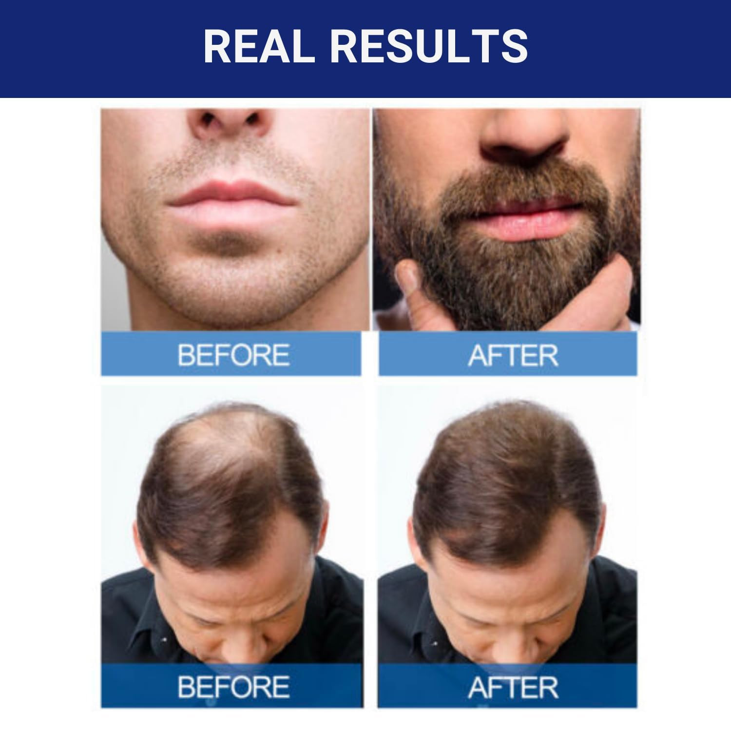 Signature 5% Minoxidil Hair Regrowth for Men – 1 Month Supply