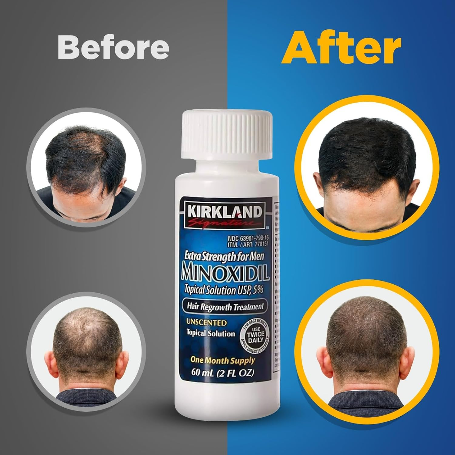 Signature 5% Minoxidil Hair Regrowth for Men – 1 Month Supply