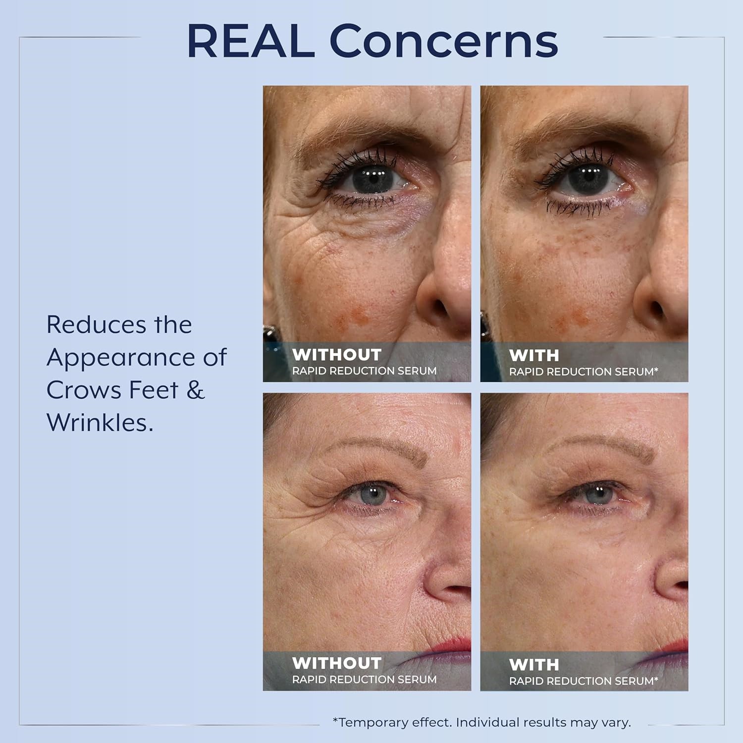 3X Plexaderm Rapid Reduction Eye Serum – Visibly Reduces Under-Eye Bags,Wrinkles