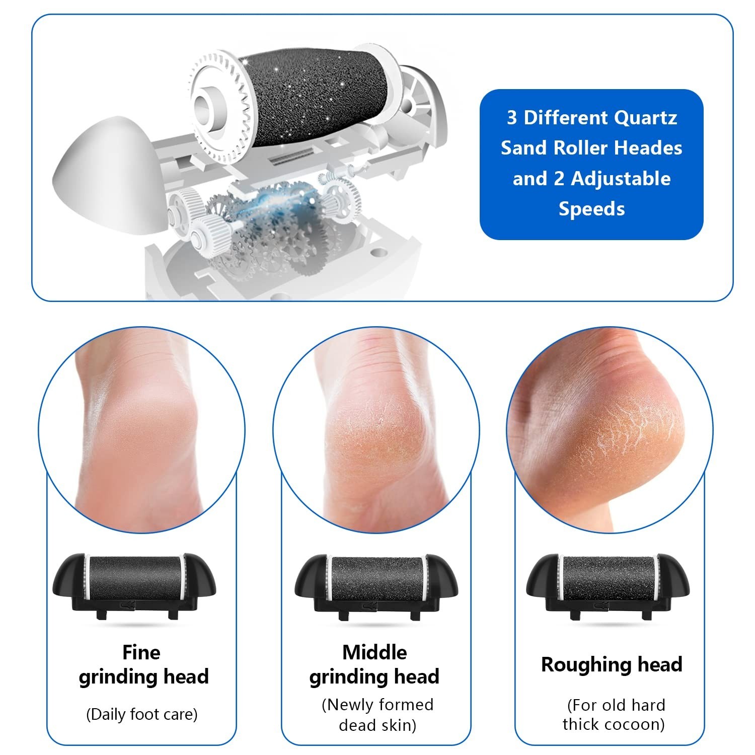 Rechargeable Electric Foot Callus Remover Kit – 3 Rollers, 2 Speeds, Battery Dis