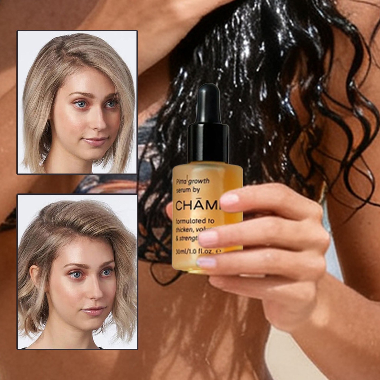 Champo Pitta Growth Serum Formulated To Thicken,Volumise&Strengthen Hair 30ml
