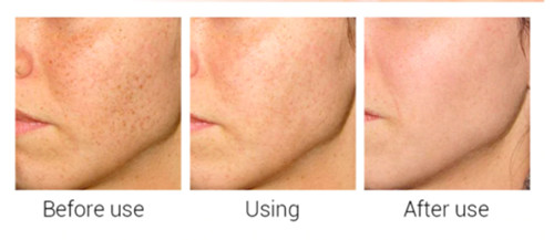 Matrixyl 3000 Peptide Hyaluronic Acid Retinol Collagen Vitamin C Cream AntiAging