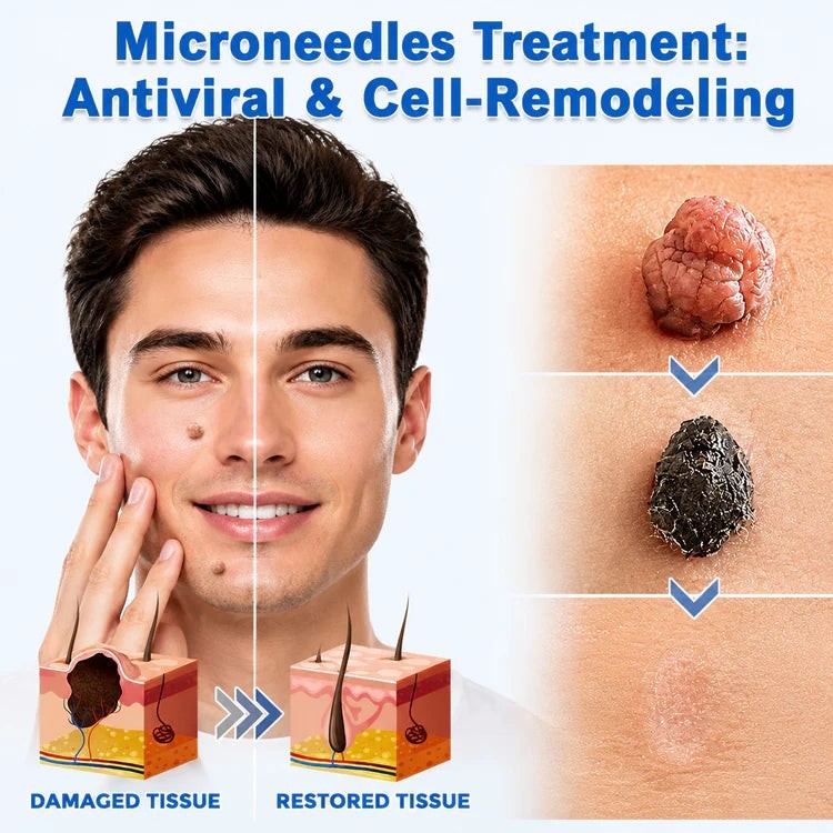 Curalona Microneedle Hydrocolloid Skin Patches Invisible Facial Body Beauty Care