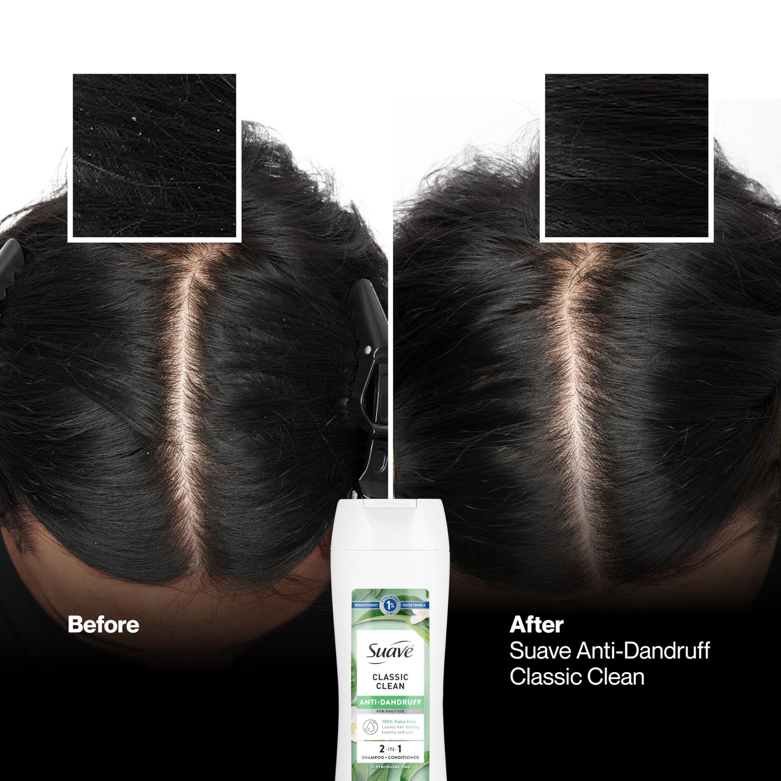 Suave Anti Dandruff 2 IN 1 Shampoo & Conditioner 12.6 Fl Oz (Pack of 1), N/A