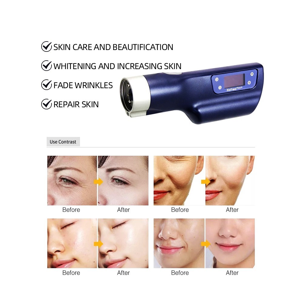 HaiFeel Micro Needle Pen Wrinkle Removal Skin Rejuvenation Machine 5 / 9 Pins