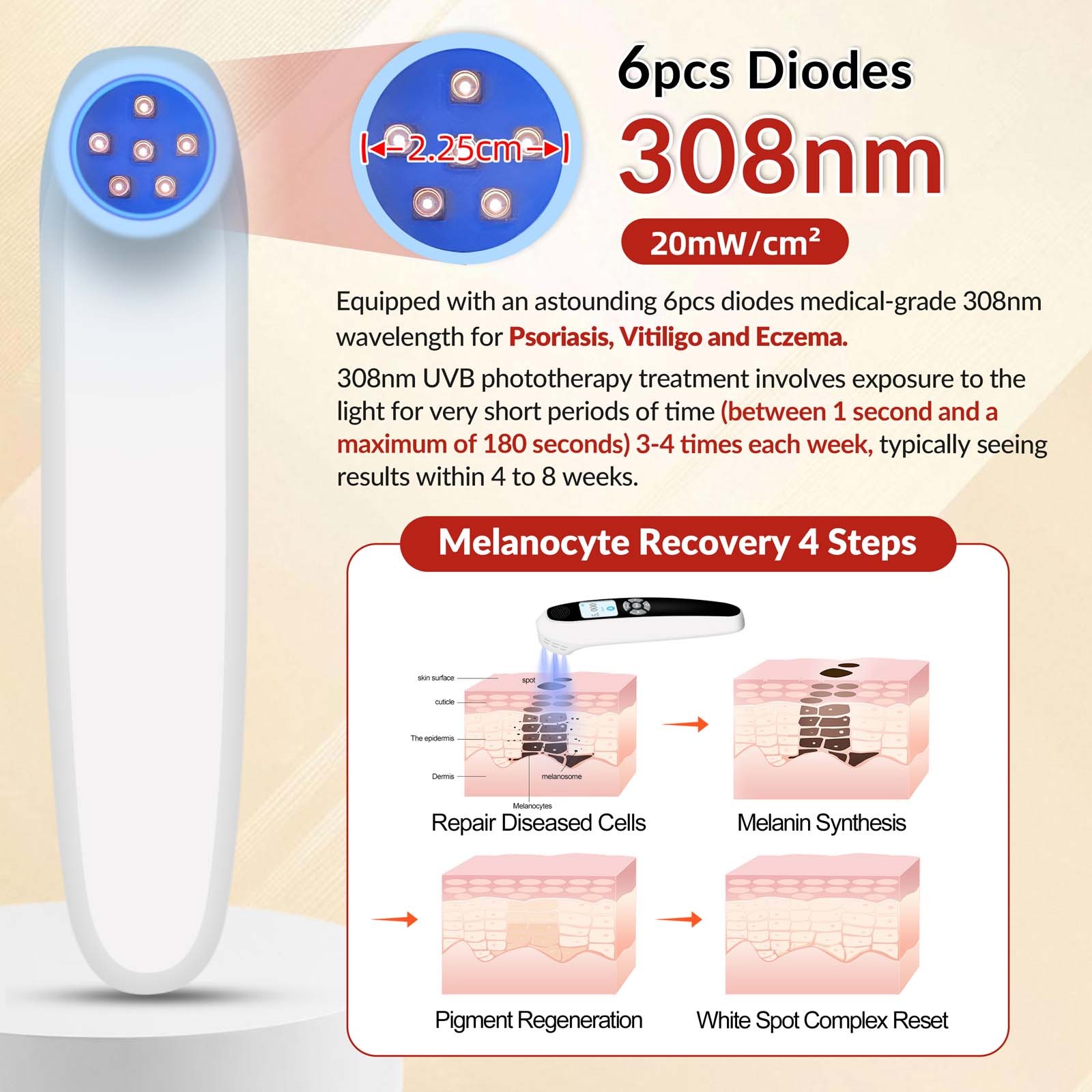 308nm Excimer Lamp UVB Light Therapy Unit 6 Diodes 20mW/cm2 Rechargeable Home