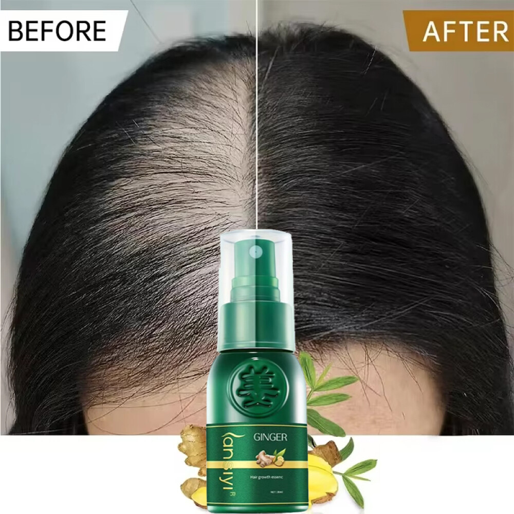 Herbal Ginger Hair Growth Spray Anti Hair Loss Treatment Dense Regrowth Essence.