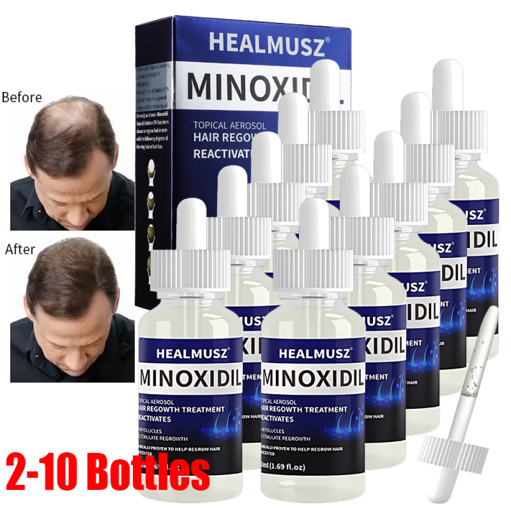 Minoxidil 5% Hair Regrowth Solution Extra Strength Men Women 2-10 Months Supply