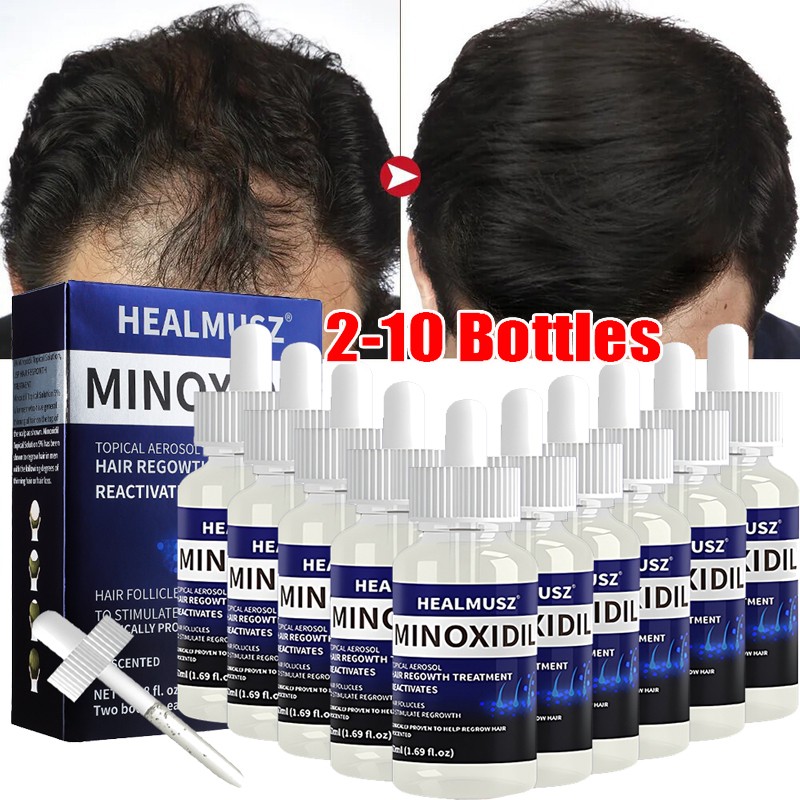 Minoxidil 5% Hair Regrowth Solution Extra Strength Men Women 2-10 Months Supply