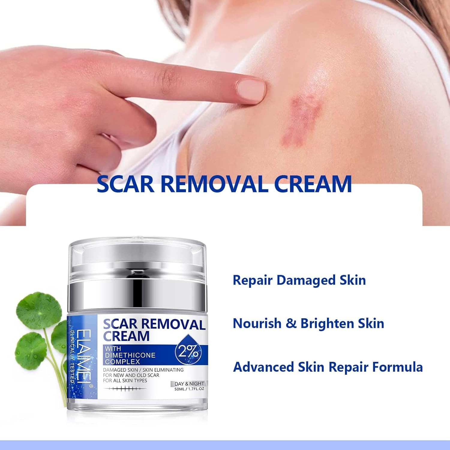 Ungüento Crema Avanzada Para Eliminar Cicatrices Quirúrgicas Quemaduras y Acné