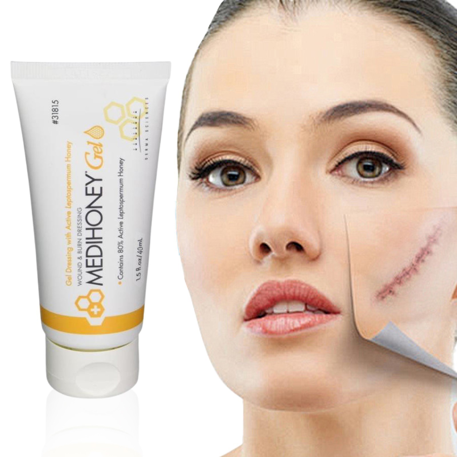 1-3Pack-Medihoney Gel Wound and Burn Dressing from Derma Sciences 1.5 oz New